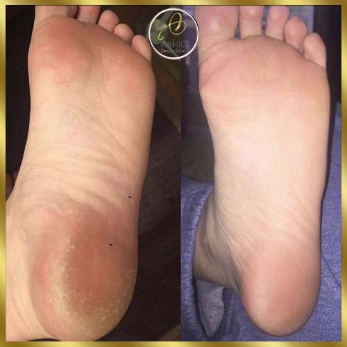 گالری پدیکور